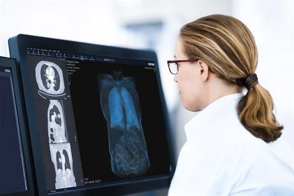 Introducing Chest - Vision AI: Your Intelligent Radiology Partner